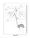 Fig. 55 - Tissue anchor
