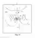 Fig. 59 - Tissue anchor