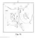 Fig. 68 - Tissue anchor