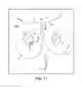 Fig. 69 - Tissue anchor