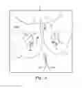Fig. 70 - Tissue anchor