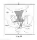 Fig. 72 - Tissue anchor