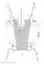 Fig. 03 - Method of fixating an implantable material in a patient