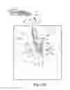 Fig. 30 - Method of fixating an implantable material in a patient