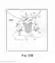Fig. 32 - Method of fixating an implantable material in a patient