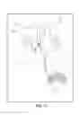 Fig. 55 - Method of fixating an implantable material in a patient