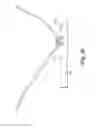 Fig. 35 - Tissue anchor system