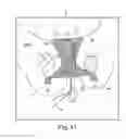 Fig. 49 - Tissue anchor system