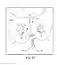 Fig. 71 - Tissue anchor system