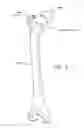 Fig. 04 - Method and apparatus for attaching tissue to bone, including the provision and use of a novel knotless suture anchor system
