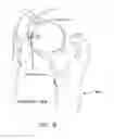 Fig. 09 - Method and apparatus for attaching tissue to bone, including the provision and use of a novel knotless suture anchor system