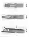 Fig. 45 - Method and apparatus for attaching tissue to bone, including the provision and use of a novel knotless suture anchor system