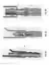 Fig. 47 - Method and apparatus for attaching tissue to bone, including the provision and use of a novel knotless suture anchor system