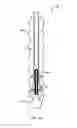 Fig. 05 - Distal tip two piece external expansion anchor
