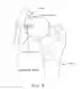 Fig. 09 - Method and apparatus for re-attaching the labrum to the acetabulum including the provision and use of a novel suture anchor system