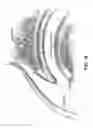 Fig. 19 - Method and apparatus for re-attaching the labrum to the acetabulum including the provision and use of a novel suture anchor system