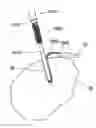 Fig. 01 - Implant placement systems, devices and methods
