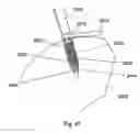 Fig. 30 - Implant placement systems, devices and methods