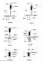 Fig. 34 - Implant placement systems, devices and methods