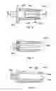 Fig. 37 - Implant placement systems, devices and methods
