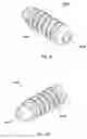 Fig. 50 - Implant placement systems, devices and methods