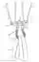 Fig. 01 - Closed loop suture for anchoring tissue grafts