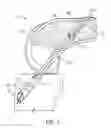 Fig. 02 - Closed loop suture for anchoring tissue grafts