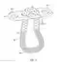 Fig. 04 - Closed loop suture for anchoring tissue grafts