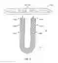Fig. 07 - Closed loop suture for anchoring tissue grafts