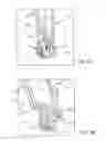 Fig. 09 - Closed loop suture for anchoring tissue grafts