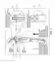 Fig. 02 - Method and apparatus for occluding a blood vessel