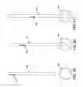 Fig. 22 - Method and apparatus for occluding a blood vessel