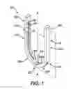 Fig. 02 - SURGICAL CLIP HAVING COMPLIANT PORTION