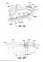 Fig. 03 - SURGICAL CLIP HAVING COMPLIANT PORTION