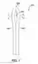 Fig. 10 - SURGICAL CLIP HAVING COMPLIANT PORTION