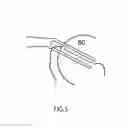 Fig. 05 - GASTROINTESTINAL DOUBLE-GRASP TISSUE FORCEPS