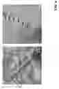 Fig. 10 - Tissue-cutting and -sealing forceps