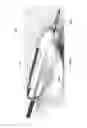 Fig. 03 - Systems and methods for percutaneous division of fibrous structures