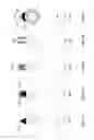 Fig. 07 - Systems and methods for percutaneous division of fibrous structures