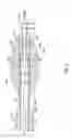 Fig. 05 - Rotatable medical device
