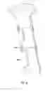 Fig. 19 - Natural orifice surgery system