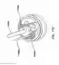 Fig. 33 - Natural orifice surgery system
