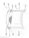 Fig. 37 - Natural orifice surgery system