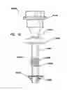 Fig. 41 - Natural orifice surgery system