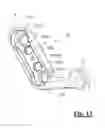 Fig. 14 - Device for locking uni-cortical pins