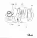 Fig. 13 - Anchoring group for an external fixator