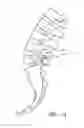 Fig. 02 - Method and apparatus for spinal stabilization