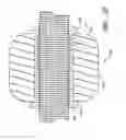 Fig. 31 - Method and apparatus for spinal stabilization