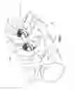 Fig. 04 - Bone fixation assembly