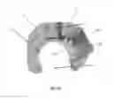 Fig. 03 - Elastic member clamps